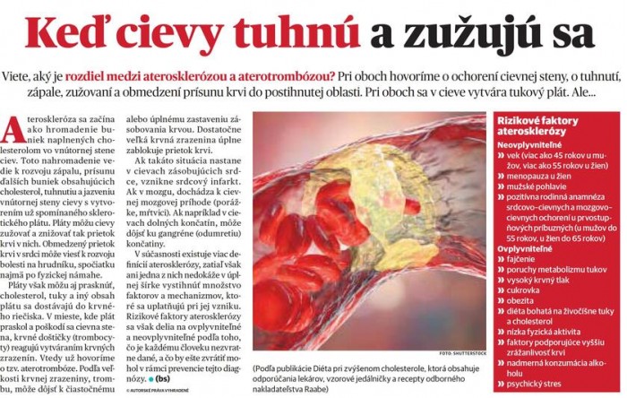 Dobré zdravie – 29.9.2021: Keď tuhnú a zužujú sa cievy