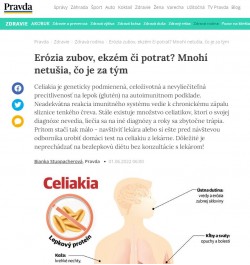 pravda.sk – 1.6.2022: Erózia zubov, ekzém či potrat? Mnohí netušia, čo je za tým
