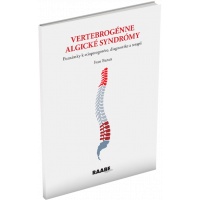 VERTEBROGÉNNE ALGICKÉ SYNDRÓMY